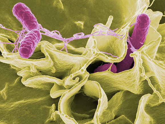Salmonella Typhimurium.